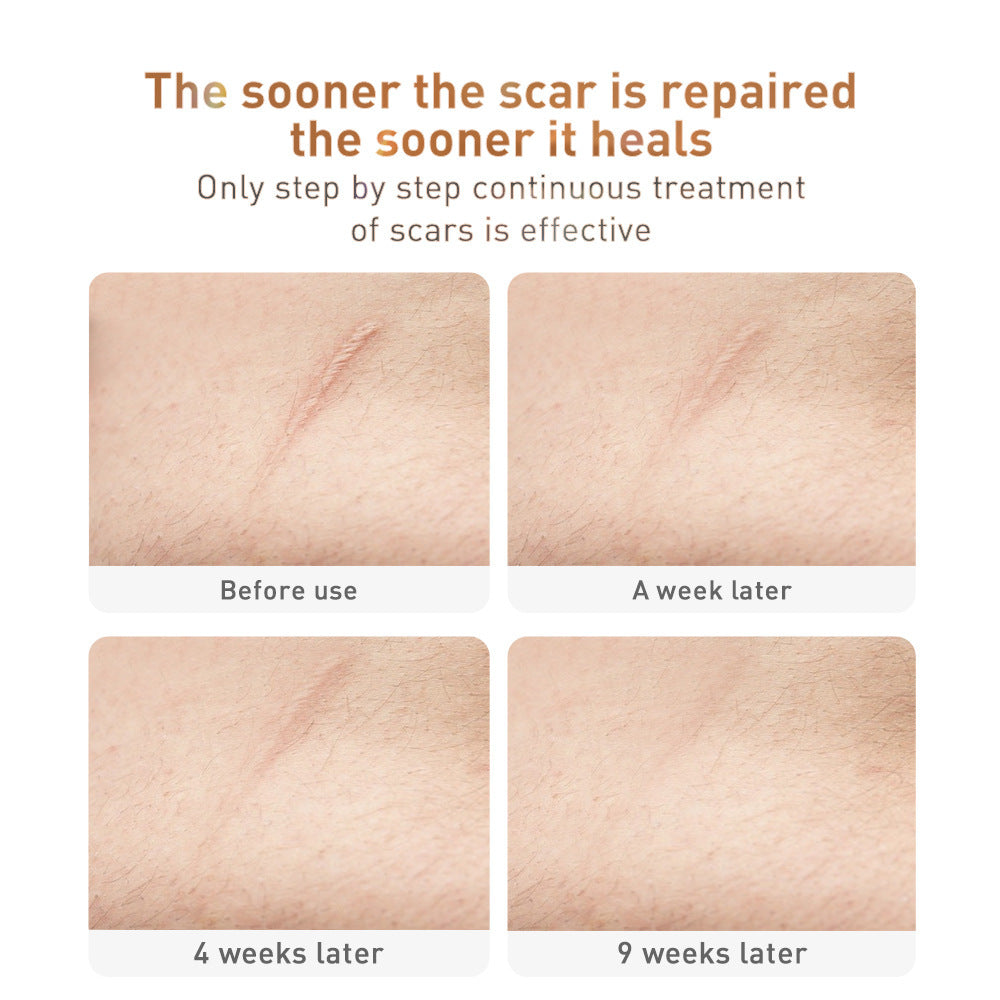 Velvière Traditional Chinese Medicine Scar Removal Cream