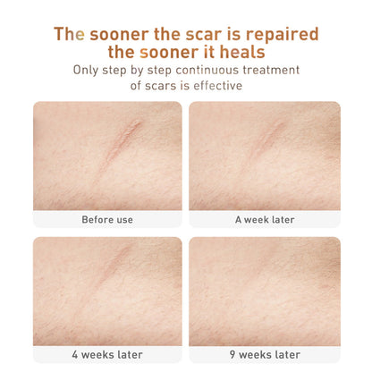 Velvière Traditional Chinese Medicine Scar Removal Cream